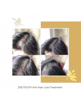 FLOREVE natūralus maisto papildas nuo plaukų slinkimo ir plaukų augimui skatinti (IN) YOUTH ANTI HAIR LOSS