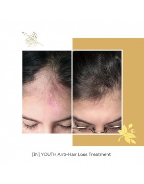 FLOREVE natūralus maisto papildas nuo plaukų slinkimo ir plaukų augimui skatinti (IN) YOUTH ANTI HAIR LOSS