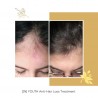 FLOREVE natūralus maisto papildas nuo plaukų slinkimo ir plaukų augimui skatinti (IN) YOUTH ANTI HAIR LOSS
